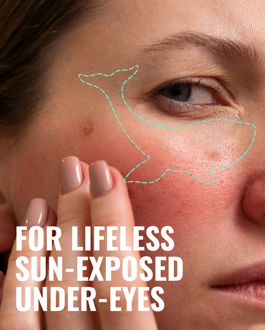 REFRESH Under Eye-Patches | Eye’m Whale Rested